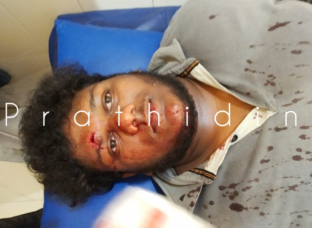 image_editor_output_image-692557284-1660463188210